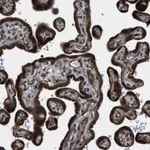 Atlas Antibodies Anti-LYSMD3 Antibody