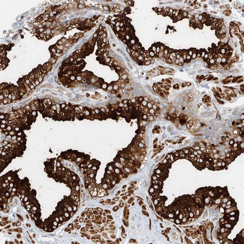 Atlas Antibodies Anti-LYRM9 Antibody