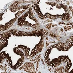 Atlas Antibodies Anti-LYRM9 Antibody