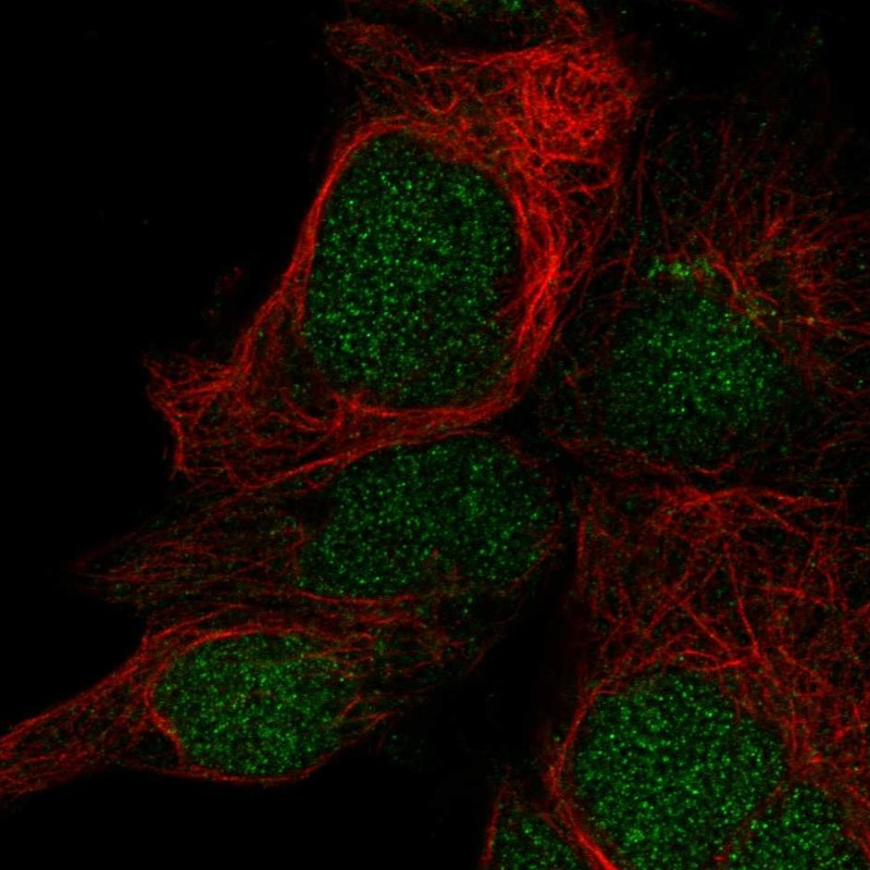 Atlas Antibodies Anti-LYSMD1 Antibody