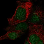 Atlas Antibodies Anti-LYSMD1 Antibody