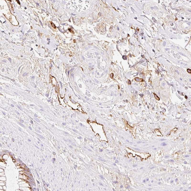 Atlas Antibodies Anti-LYVE1 Antibody