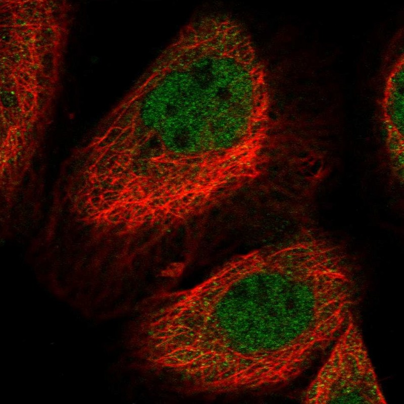 Atlas Antibodies Anti-LYST Antibody