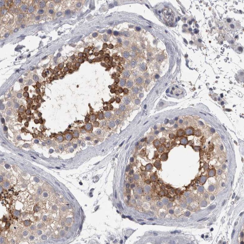 Atlas Antibodies Anti-LYZL6 Antibody
