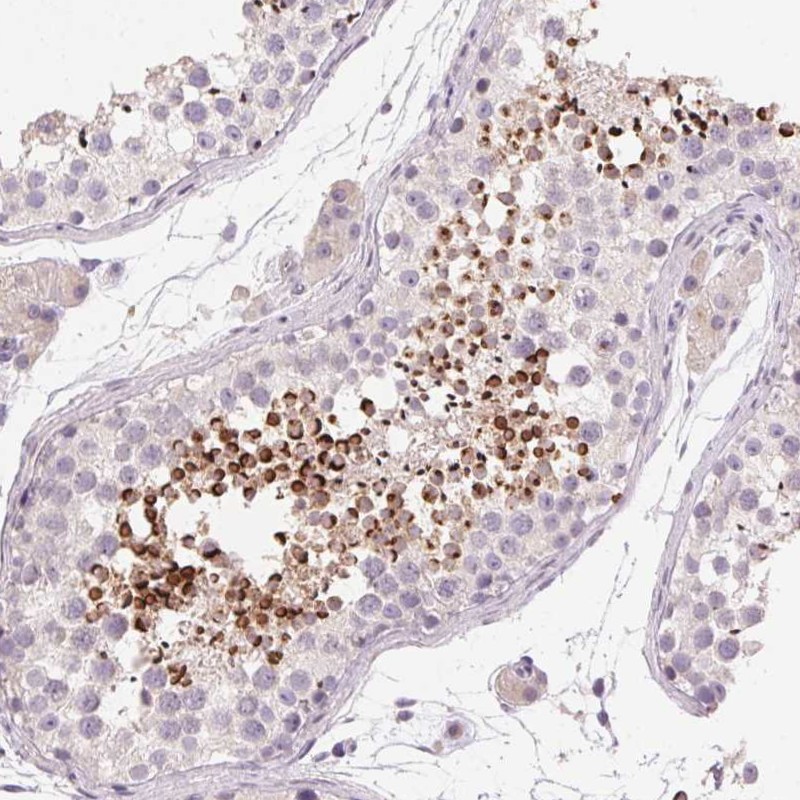 Atlas Antibodies Anti-LYZL6 Antibody