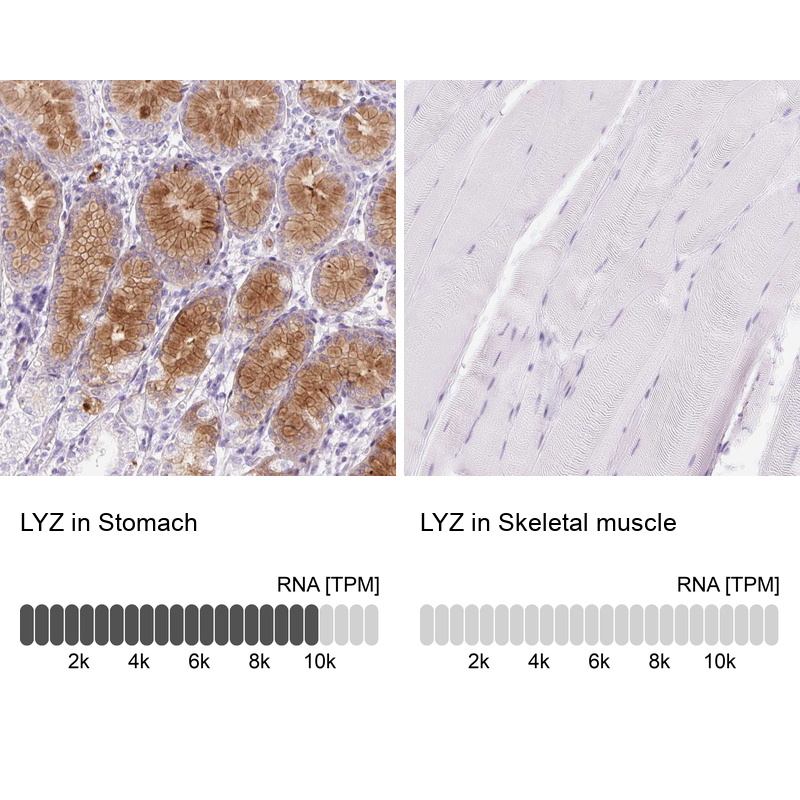 Atlas Antibodies Anti-LYZ Antibody