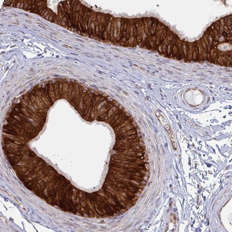 Atlas Antibodies Anti-LYSMD4 Antibody