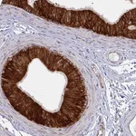 Atlas Antibodies Anti-LYSMD4 Antibody