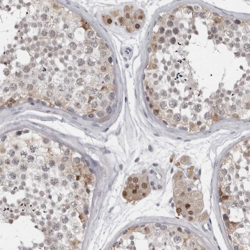 Atlas Antibodies Anti-LZIC Antibody