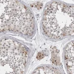 Atlas Antibodies Anti-LZIC Antibody