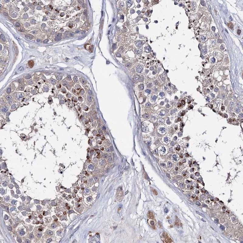Atlas Antibodies Anti-LYZL4 Antibody