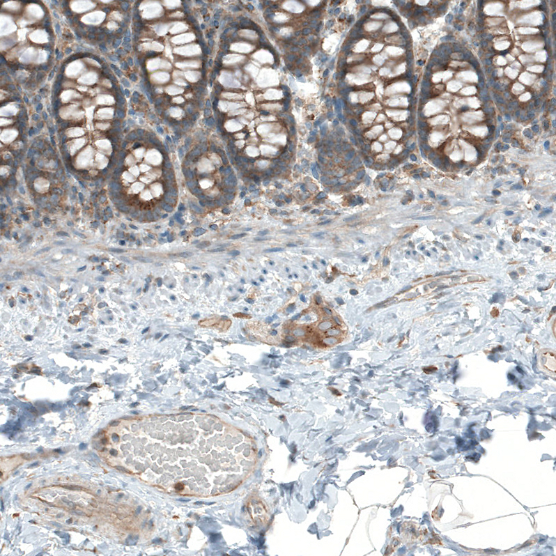 Atlas Antibodies Anti-LZTR1 Antibody
