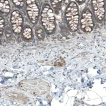 Atlas Antibodies Anti-LZTR1 Antibody