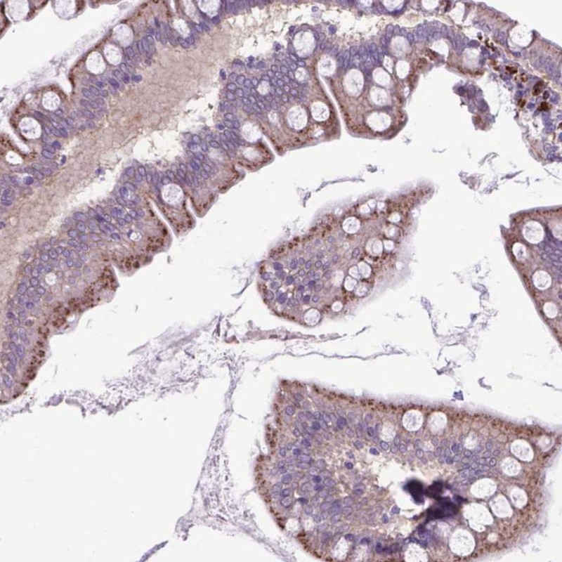 Atlas Antibodies Anti-LZTR1 Antibody