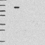 Atlas Antibodies Anti-LZTR1 Antibody