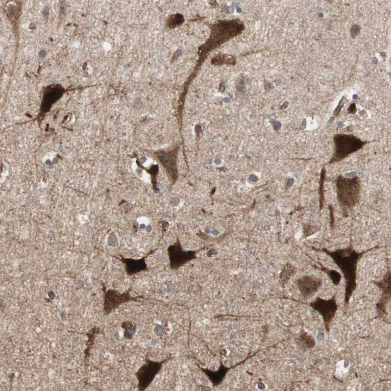 Atlas Antibodies Anti-LZTS1 Antibody