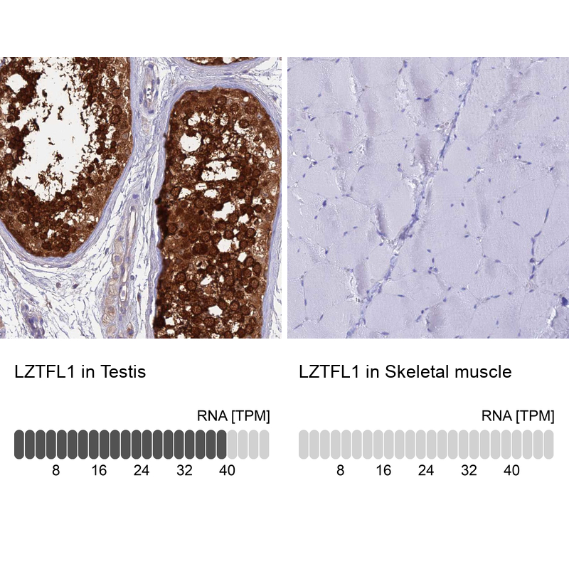 Atlas Antibodies Anti-LZTFL1 Antibody