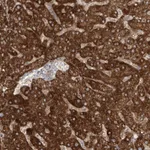 Atlas Antibodies Anti-LZTS3 Antibody