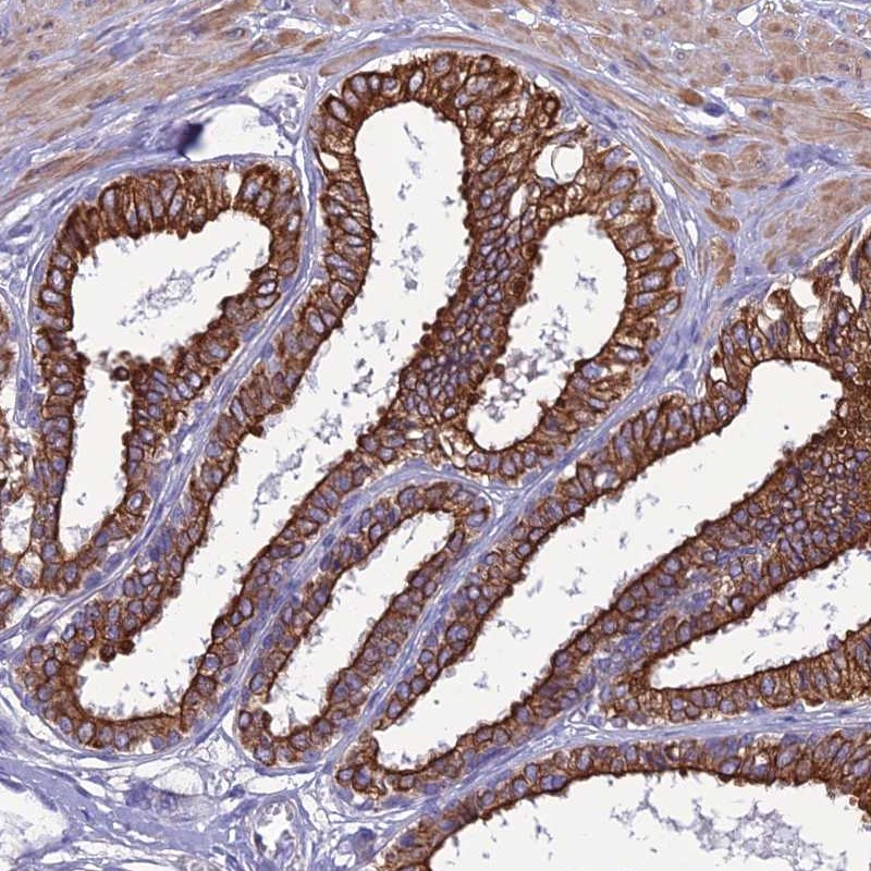 Atlas Antibodies Anti-LZTS2 Antibody
