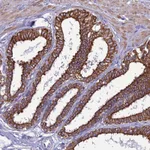 Atlas Antibodies Anti-LZTS2 Antibody