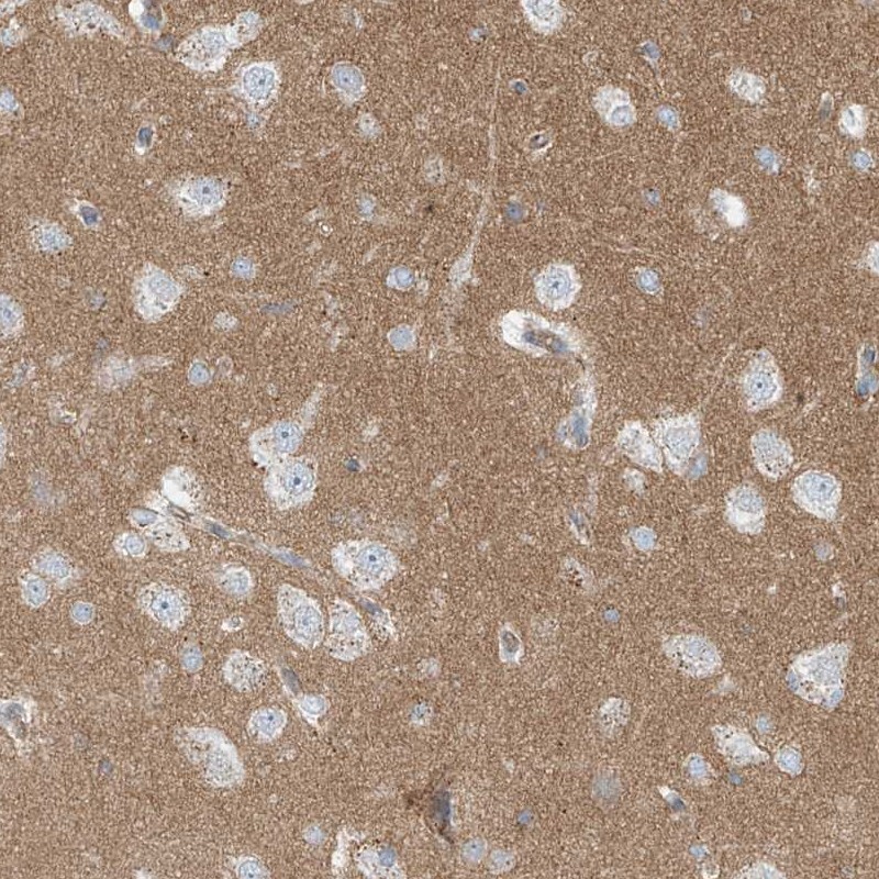 Atlas Antibodies Anti-LZTS3 Antibody