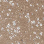 Atlas Antibodies Anti-LZTS3 Antibody