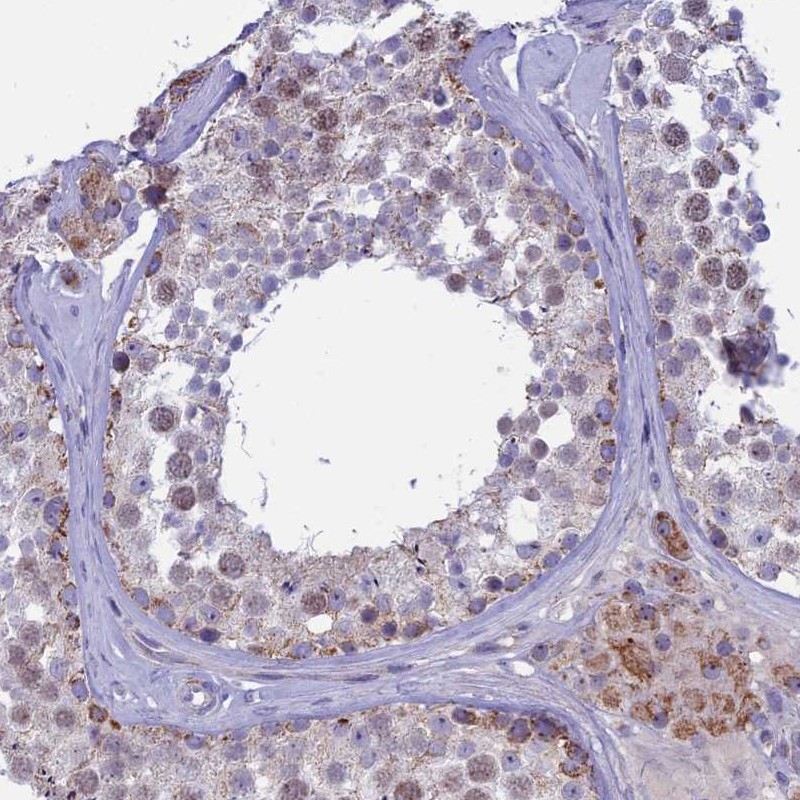 Atlas Antibodies Anti-M1AP Antibody