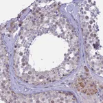 Atlas Antibodies Anti-M1AP Antibody