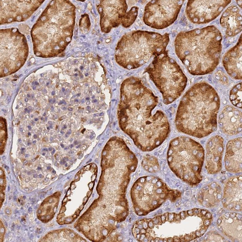 Atlas Antibodies Anti-M6PR Antibody