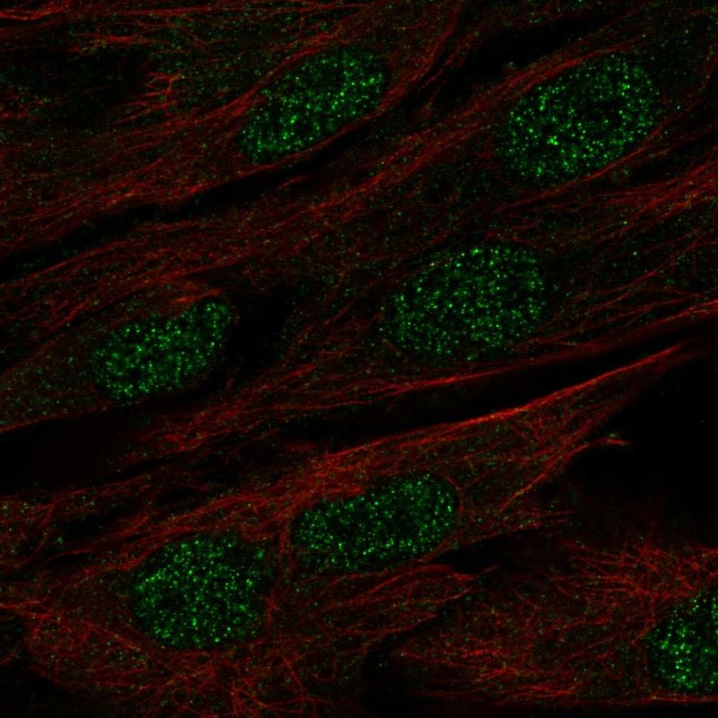 Atlas Antibodies Anti-MAB21L1 Antibody
