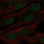 Atlas Antibodies Anti-MAB21L1 Antibody
