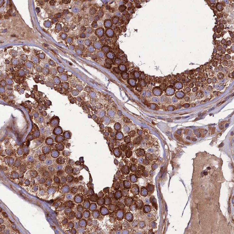 Atlas Antibodies Anti-MAB21L3 Antibody
