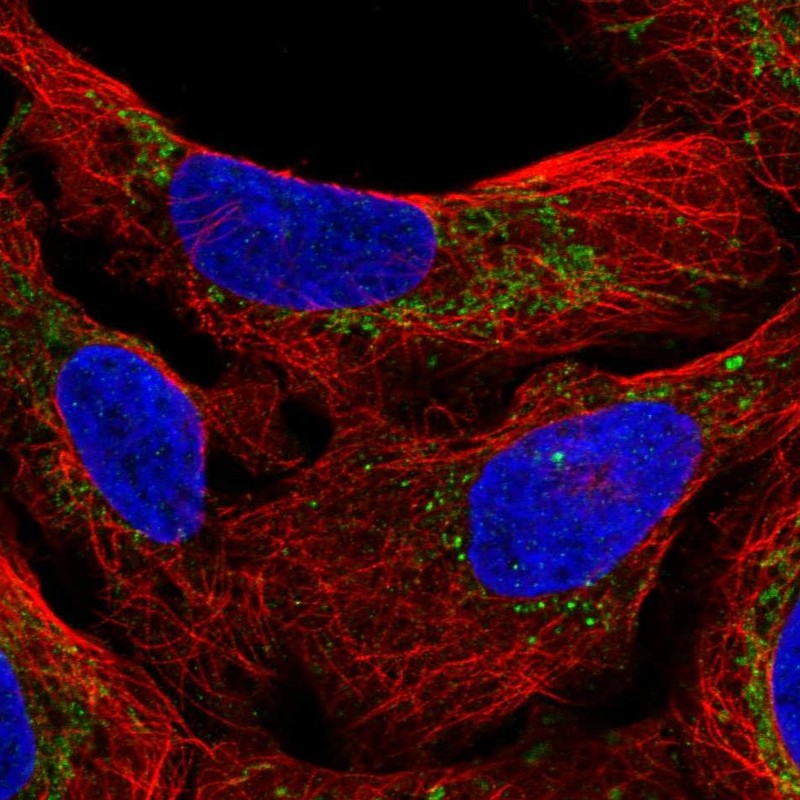 Atlas Antibodies Anti-M1AP Antibody