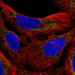 Atlas Antibodies Anti-M1AP Antibody