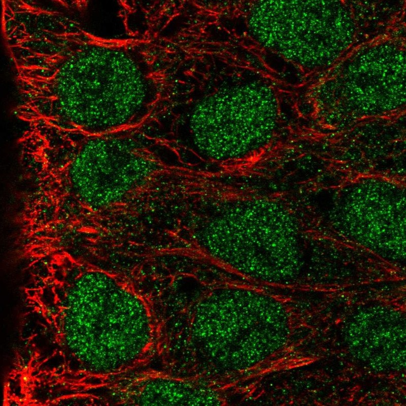 Atlas Antibodies Anti-MAB21L3 Antibody