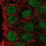 Atlas Antibodies Anti-MAB21L3 Antibody