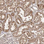 Atlas Antibodies Anti-MACC1 Antibody