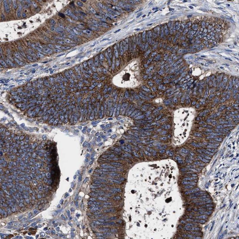 Atlas Antibodies Anti-MACC1 Antibody