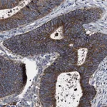 Atlas Antibodies Anti-MACC1 Antibody