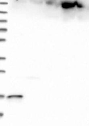 Atlas Antibodies Anti-MAD2L2 Antibody