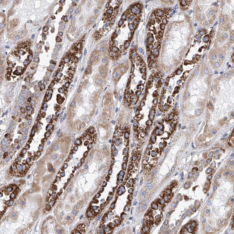 Atlas Antibodies Anti-MAD2L1 Antibody