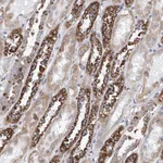 Atlas Antibodies Anti-MAD2L1 Antibody