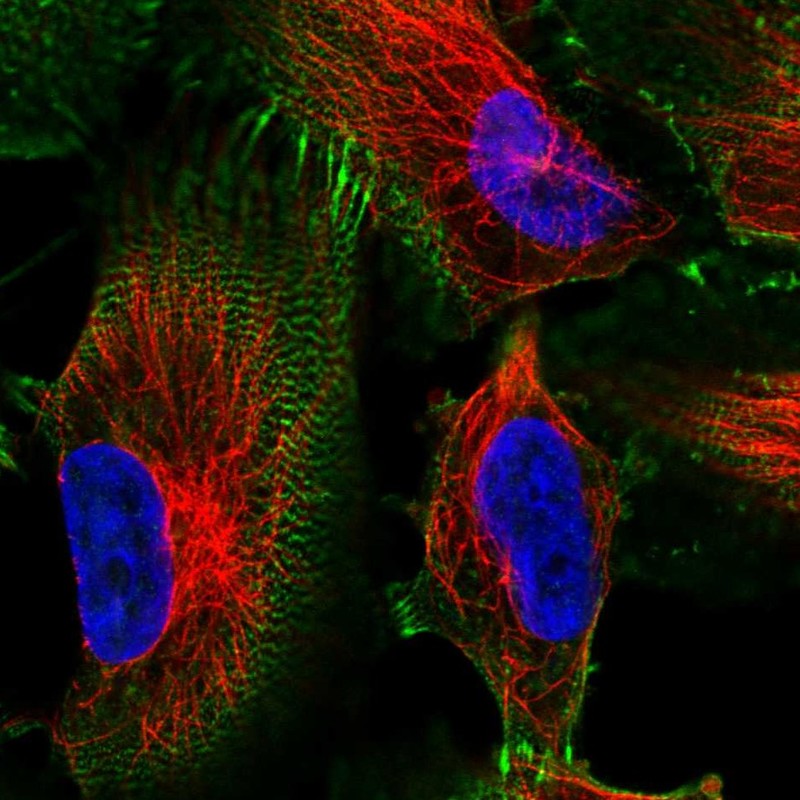 Atlas Antibodies Anti-MACF1 Antibody