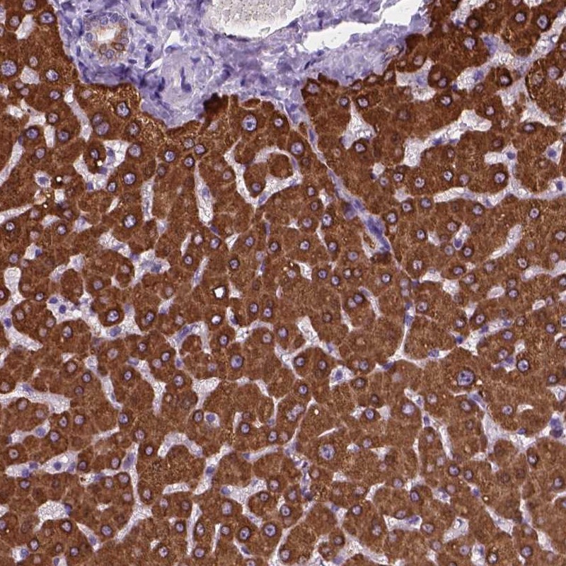 Atlas Antibodies Anti-MACF1 Antibody