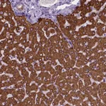 Atlas Antibodies Anti-MACF1 Antibody
