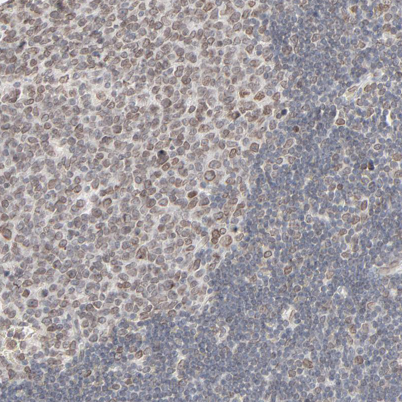 Atlas Antibodies Anti-MAD1L1 Antibody