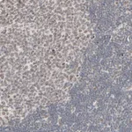 Atlas Antibodies Anti-MAD1L1 Antibody