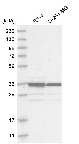 Atlas Antibodies Anti-MAD2L1BP Antibody