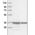 Atlas Antibodies Anti-MAD2L1BP Antibody