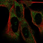 Atlas Antibodies Anti-MAD2L2 Antibody